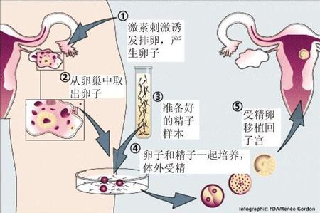 生殖妇科